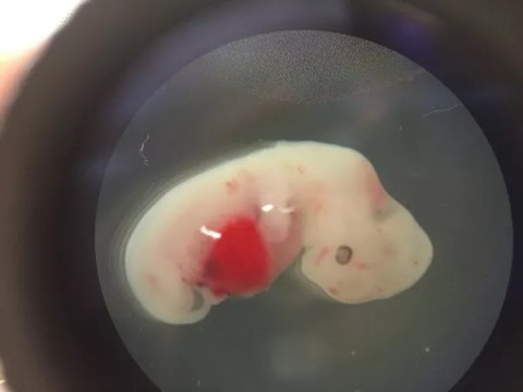 Foto divulgada pelo Instituto Salk mostra um embrião de porco com 4 semanas que teve células-tronco humanas injetadas. 