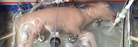 Cordeiro prematuro cultivado com sucesso dentro de um útero artificial em 2017. Fonte: https://screenshot-magazine.com/politics/human-rights/what-is-artificial-womb/ )