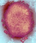  “ ...HAVERÁ PESTES” (Mt 24,7)   Está sendo criada uma versão do Monkeypox “1.000 vezes mais letal do que o normal”