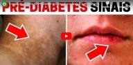8 sinais de alerta de pré-diabetes (vídeo) 