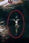A ecografia mostrou a imagem de Jesus na Cruz e o aborto foi descartado