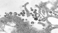 “ ...HAVERÁ PESTES” (Mt 24,7)  Duas pessoas são diagnosticadas com doença semelhante ao Ebola  