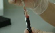 Químicos estão presentes na nossa corrente sanguínea e podem persistir por anos no corpo humano