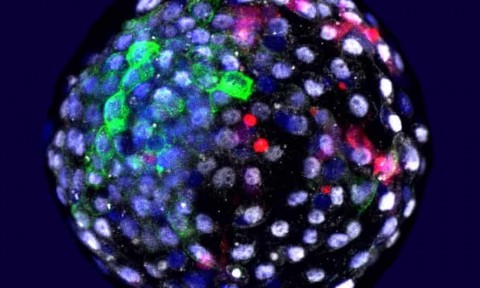 Uma foto emitida pelo Salk Institute mostra células humanas cultivadas em um embrião de macaco em estágio inicial. Fotografia: Weizhi Ji/Kunming Universidade de Ciência e Tecnologia/PA
