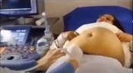 “AI DAS QUE ESTIVEREM GRÁVIDAS E DAS QUE AMAMENTAREM NAQUELES DIAS!” (Lc 21, 23)  Bizarro! Veja o que está acontecendo no ventre de uma mãe grávida (vídeo)