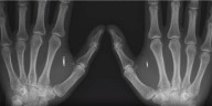 ʺ...UM SINAL NA SUA MÃO DIREITA, OU NA SUA TESTA, PARA QUE NINGUÉM POSSA COMPRAR OU VENDER... ʺ (Ap 13, 16-17) Especialista do setor bancário adverte que os CBDCs serão chips implantados 