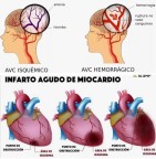 10 anticoagulantes naturais que ajudam a evitar doenças como AVC e Infarto